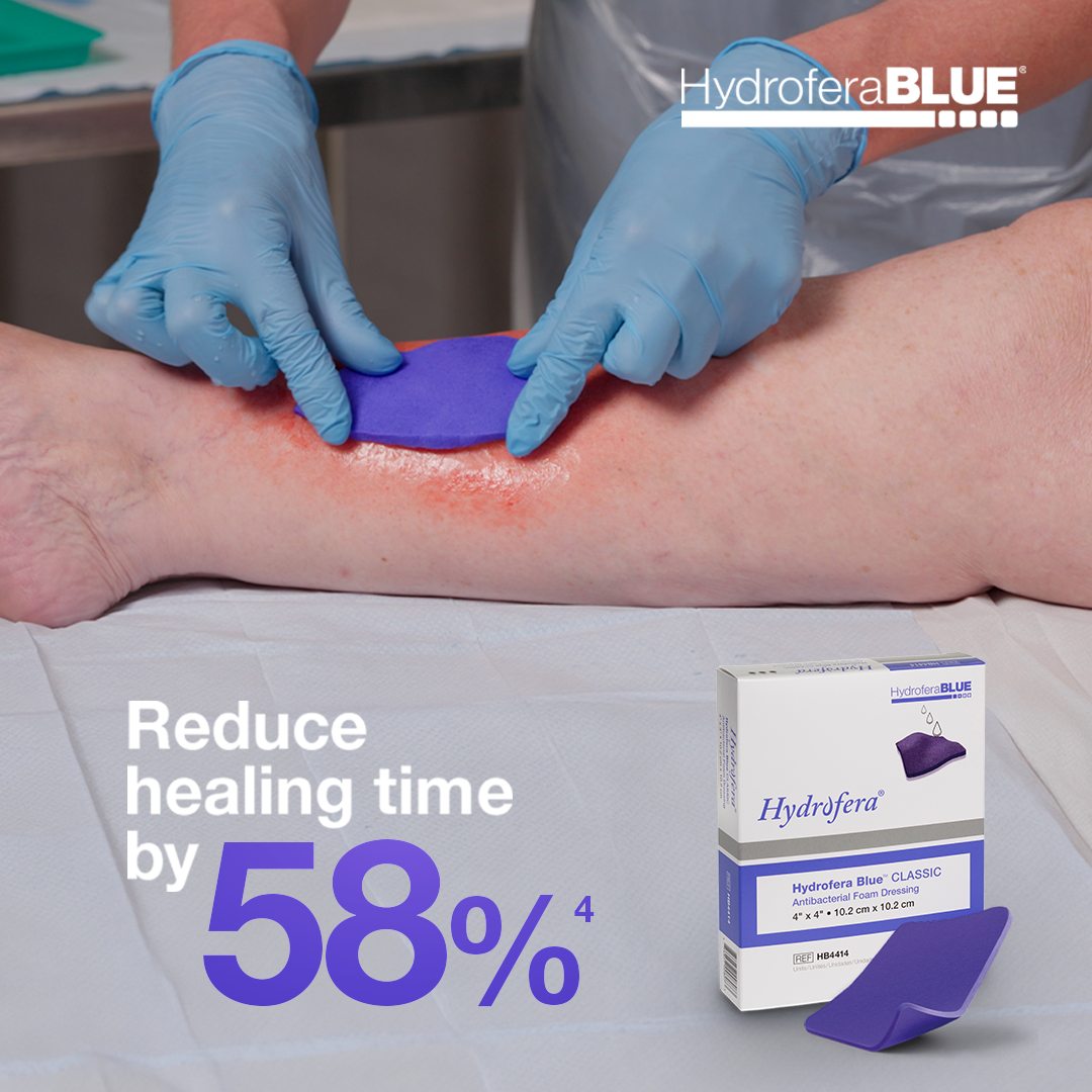 58% reduction in healing time with Hydrofera Blue CLASSIC, reference 4