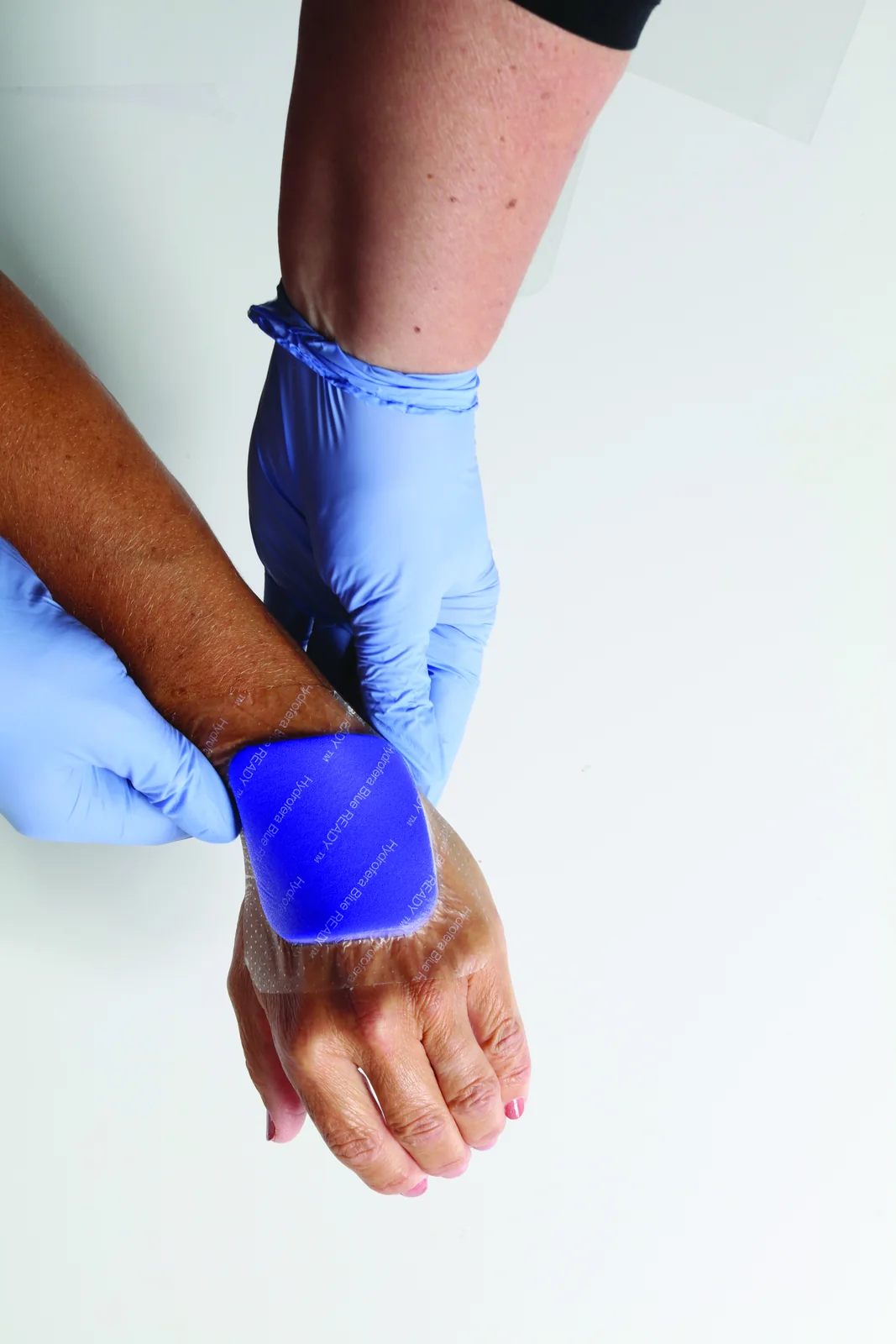Hydrofera Blue READY-Border dressing applied to a patient arm