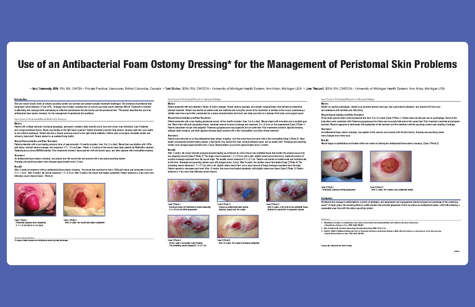 Cover preview for Use of an Antibacterial Foam Ostomy Dressing for the Management of Peristomal Skin Problems